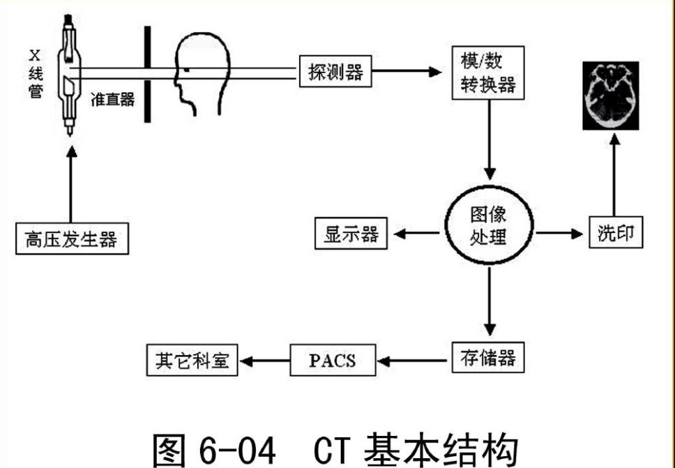 濾光片 CT結(jié)構(gòu)原理