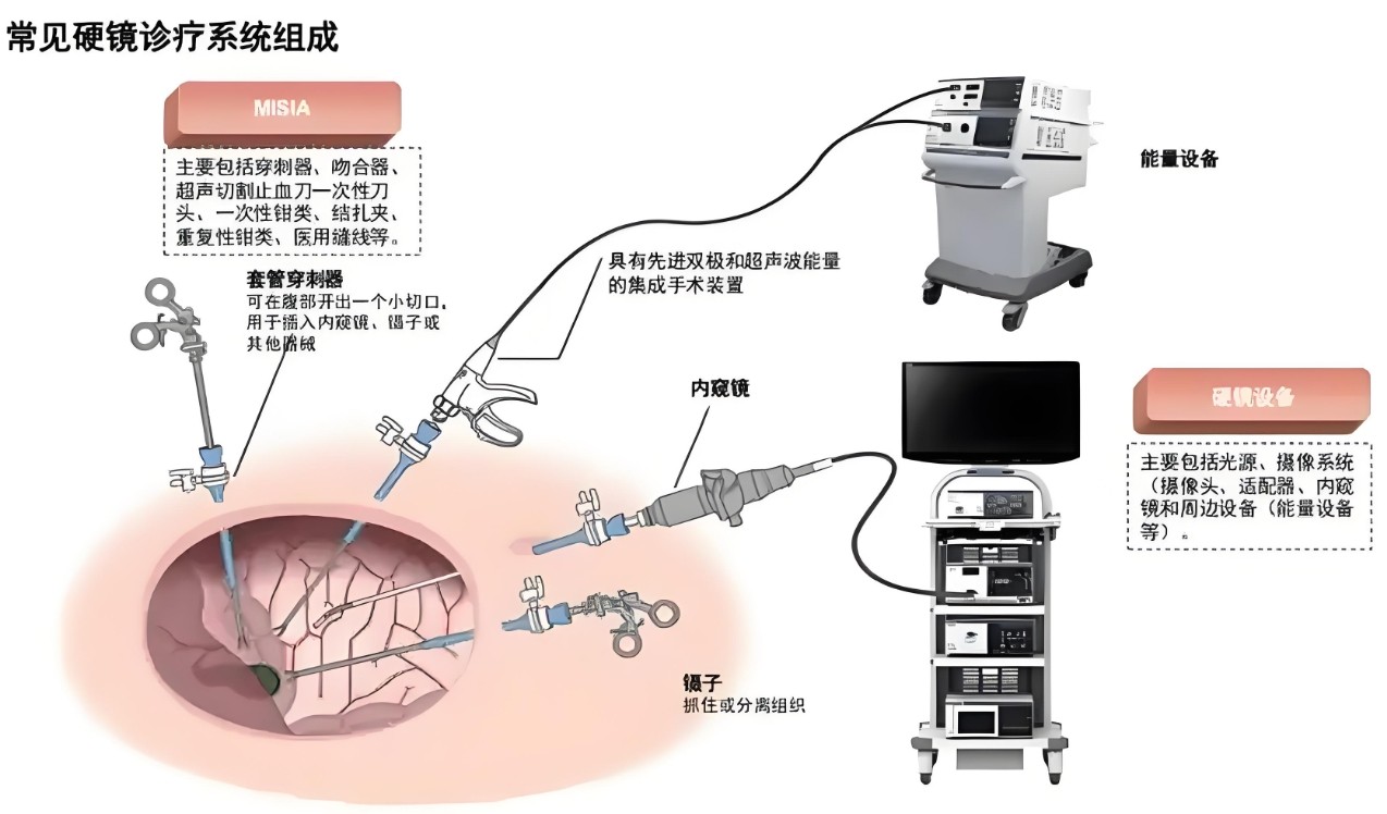常見(jiàn)硬鏡診療系統(tǒng)組成