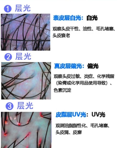 不同光對頭發(fā)的觀測效果 不同光對頭發(fā)的觀測效果