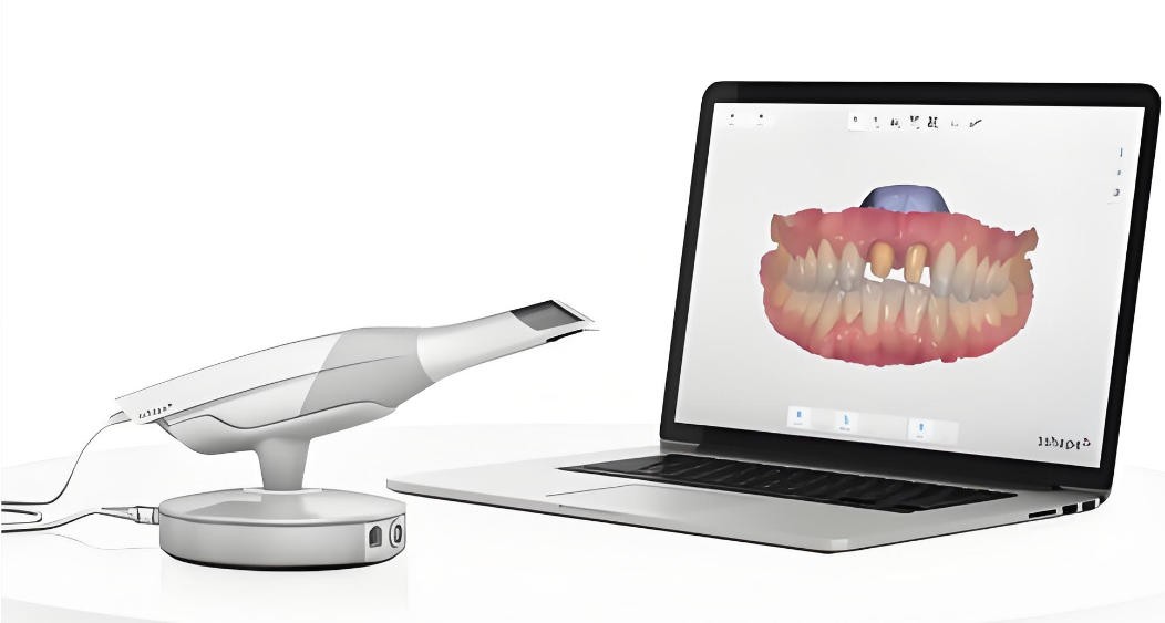 三維口內(nèi)掃描儀